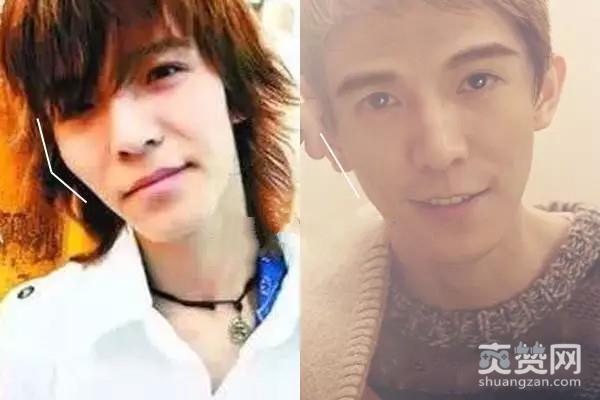 郭敬明骚扰男作家,整容,爽赞网