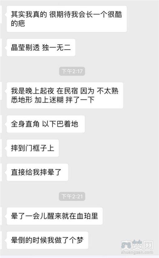 影后自杀？周冬雨下巴惊现3厘米疤痕事件始末