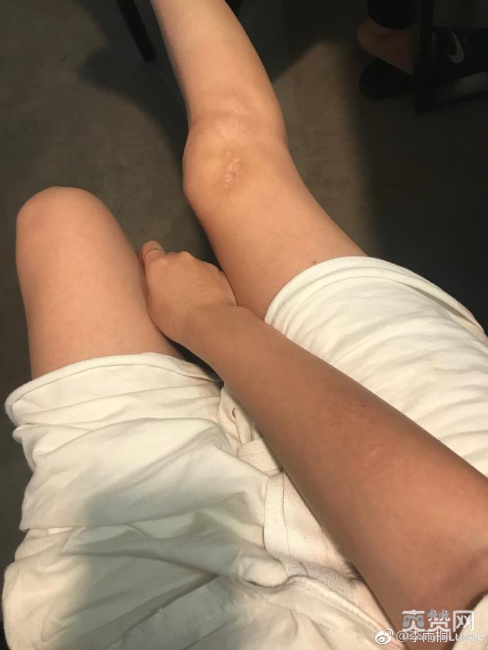 网红曝被薛之谦骗 李雨桐又曝新料称当年出车祸薛之谦隐瞒真相