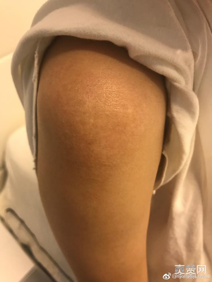 网红曝被薛之谦骗 李雨桐又曝新料称当年出车祸薛之谦隐瞒真相